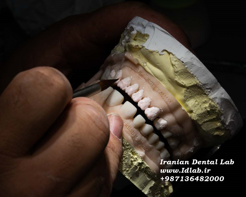 لابراتوار تخصصی دندانسازی ایرانیان